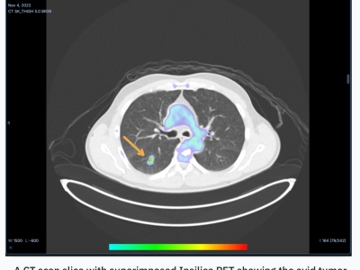 RADiCAIT از دانشگاه آکسفورد: هوش مصنوعی برای تصویربرداری پزشکی ارزان‌تر و در دسترس‌